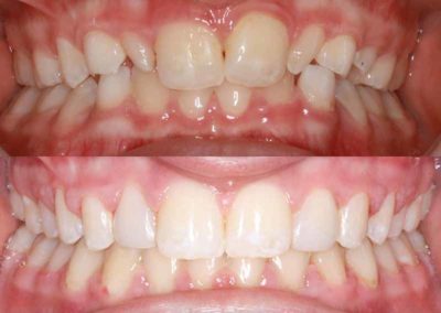 Orthodontic corrections by Scott Family Orthodontics